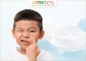 Kính áp tròng ban đêm Ortho-K
