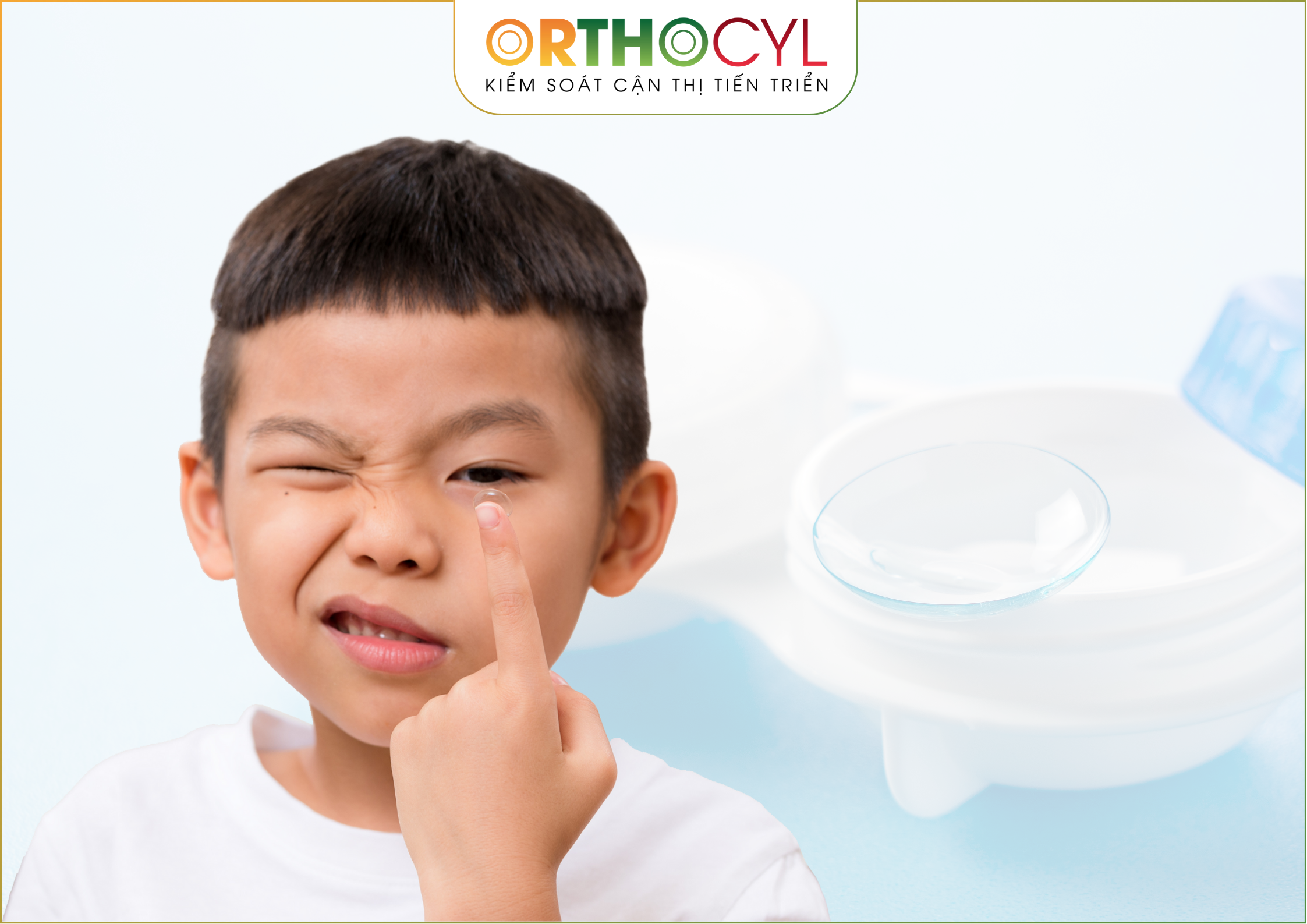 Kính áp tròng ban đêm Ortho-K