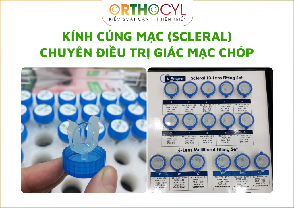 Kính củng mạc (scleral)