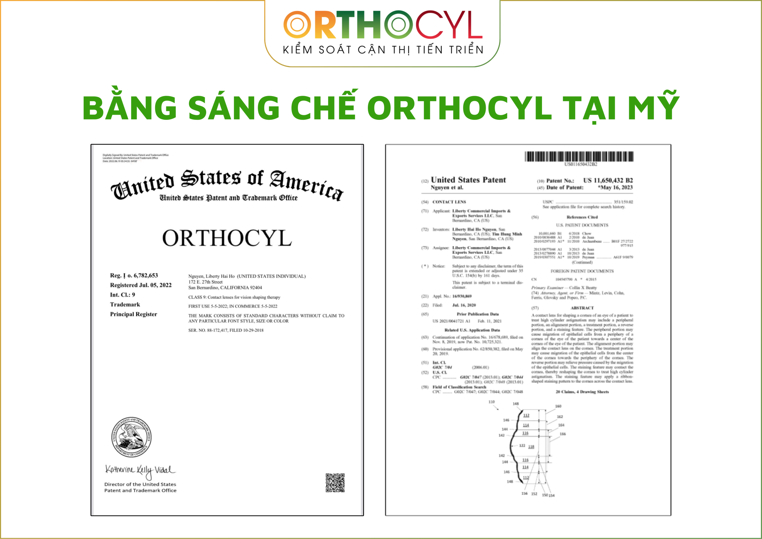 bằng sáng chế kính ortho-k, orthocyl