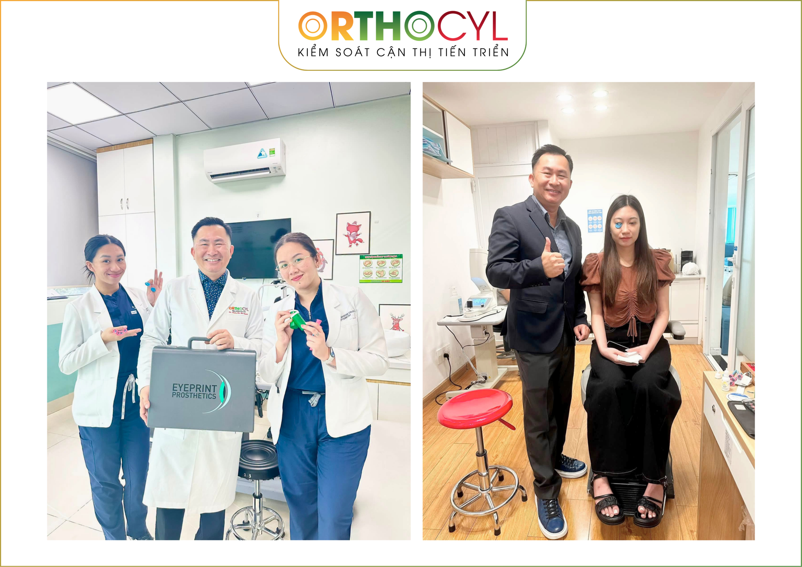 EyePrintPRO, kính củng mạc, scleral, giác mạc chóp, khô mắt, sẹo giác mạc, cận loạn cao, điều trị sau phẫu thuật