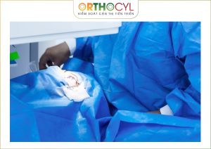 https://orthok.vn/dieu-tri-giac-mac-chop-bang-kinh-cung-mac-scleral/