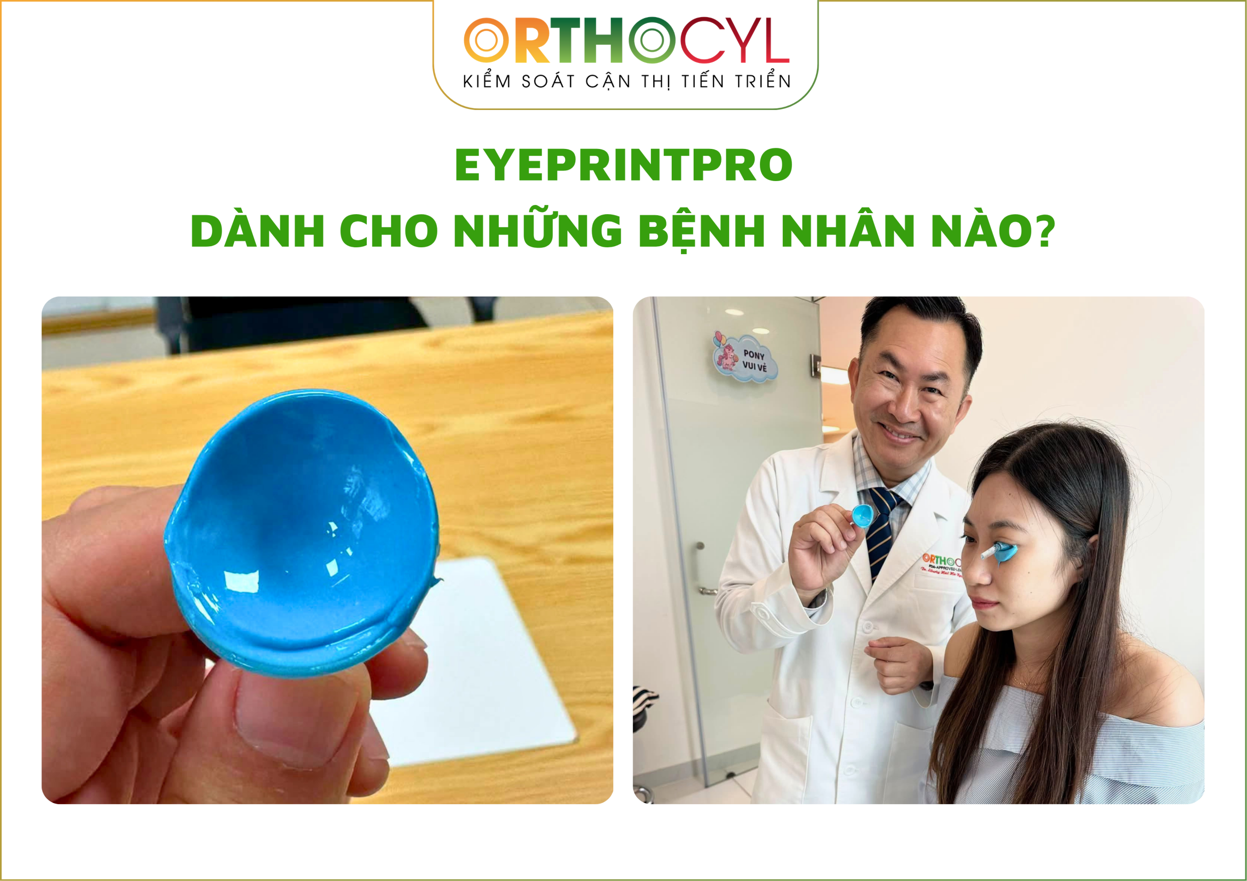 EyePrintPRO, kính củng mạc, scleral, giác mạc chóp, khô mắt, sẹo giác mạc, cận loạn cao, điều trị sau phẫu thuật