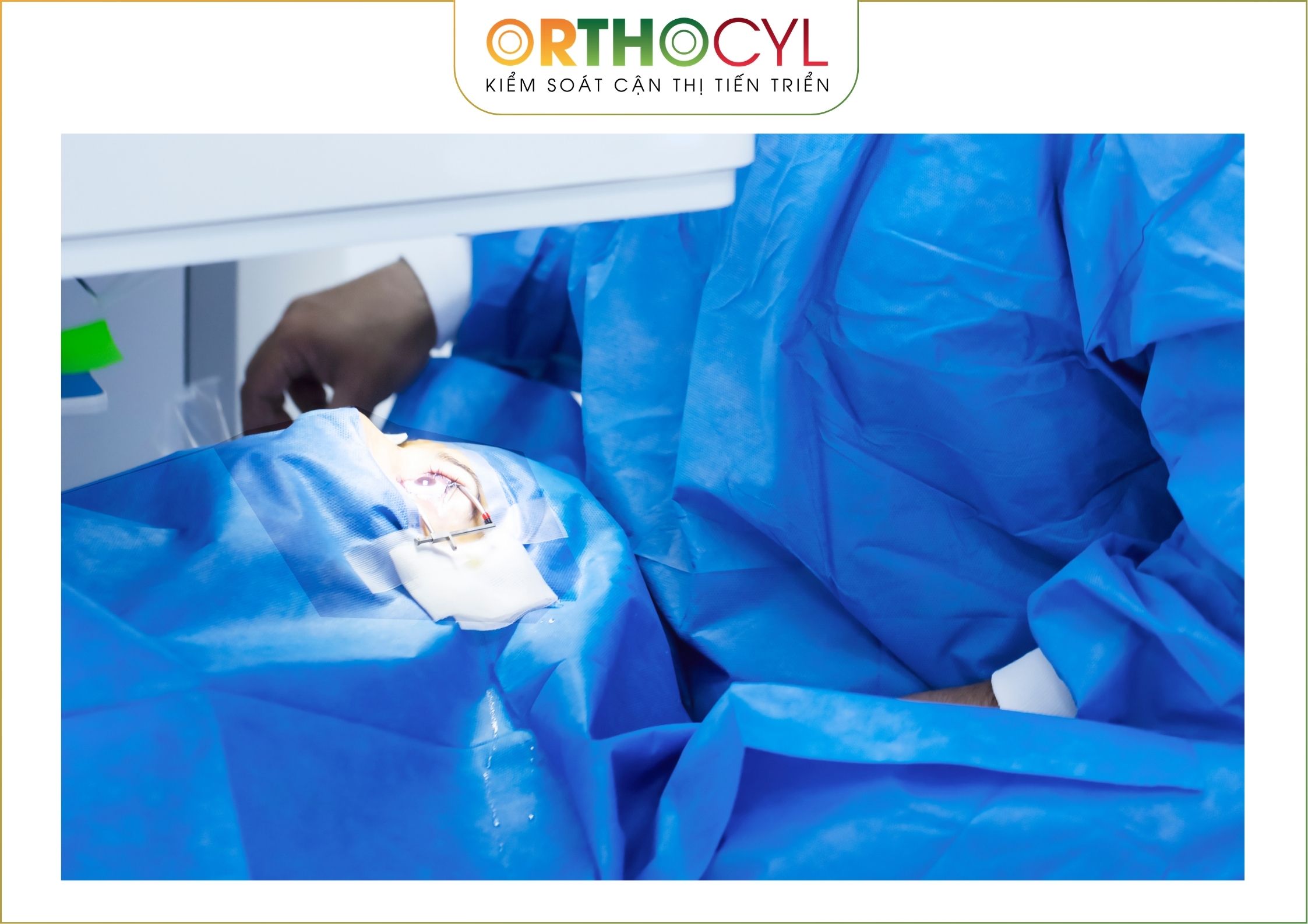 https://orthok.vn/dieu-tri-giac-mac-chop-bang-kinh-cung-mac-scleral/